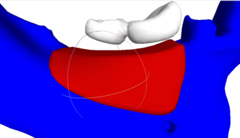 RBB 06. Модель челюсти, модель блока, встречные зубы