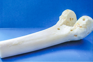 Фрагмент - эпифиз локтевой кости